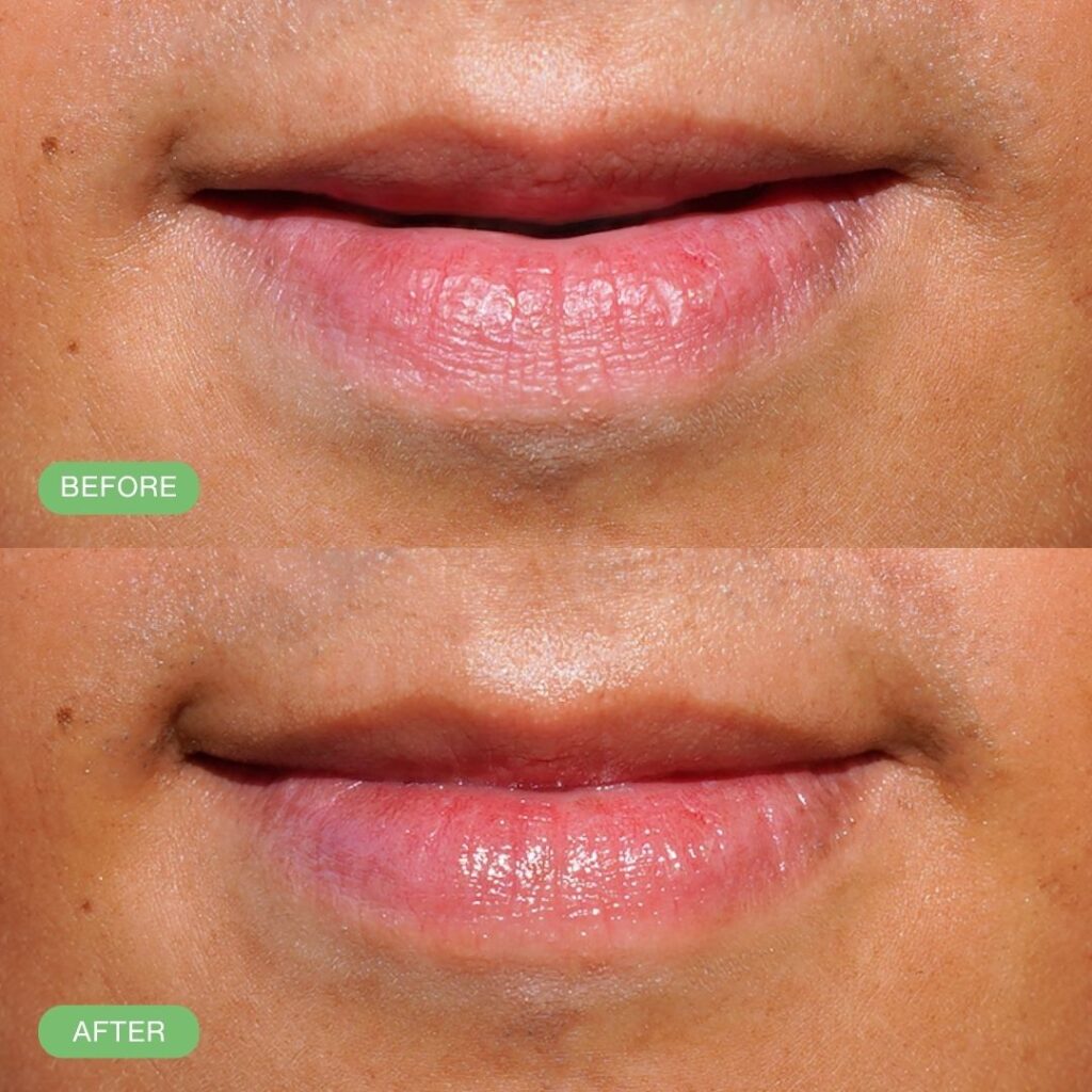 Hydrating Lip Balm Elderberry
